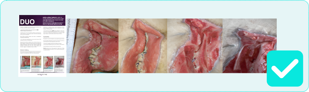 DUO Genadyne Case Studies