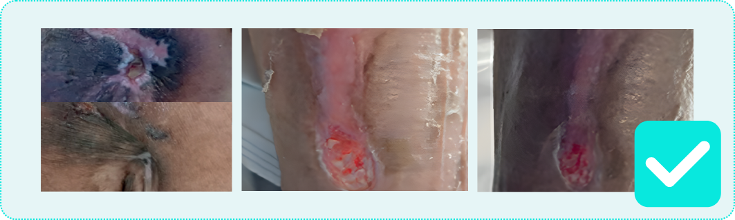 Copper dressings vs silver dressings