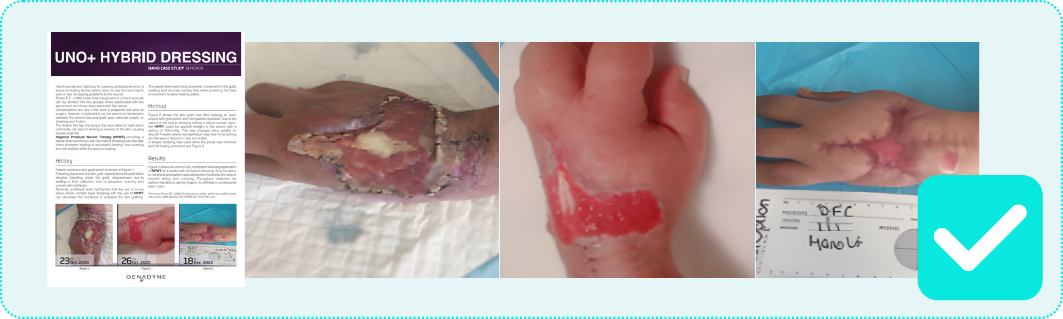 UNO+ Genadyne Clinical Efficacy