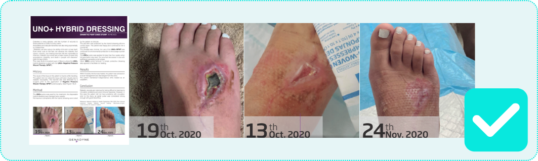 UNO+ Genadyne Clinical Paper